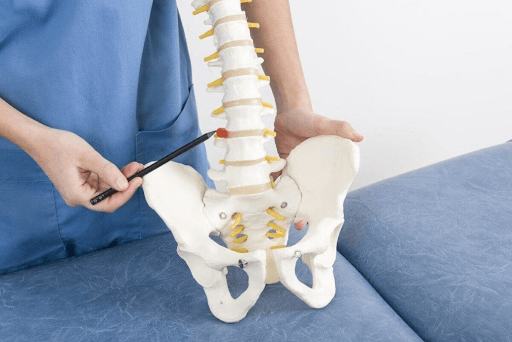 Thoát vị đĩa đệm cũng là nguyên nhân phổ biến gây đau cơ mông