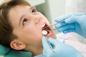 Điều trị tình trạng sâu răng ở trẻ