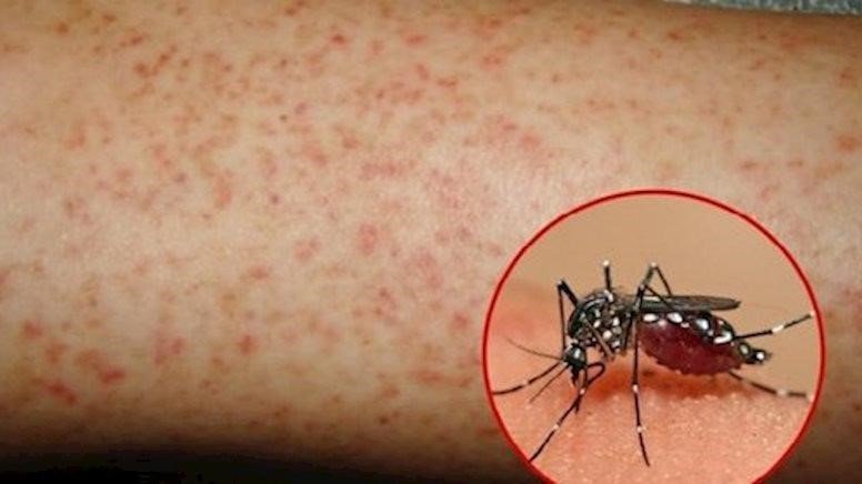 Muỗi là một trong những đường lây truyền bệnh sốt virus