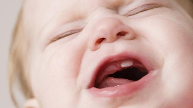 Trẻ chậm mọc răng có ảnh hưởng gì không?