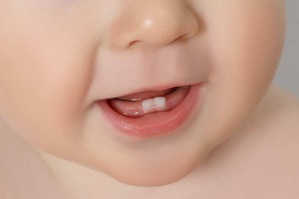 Những lưu ý khi trẻ mọc răng sớm