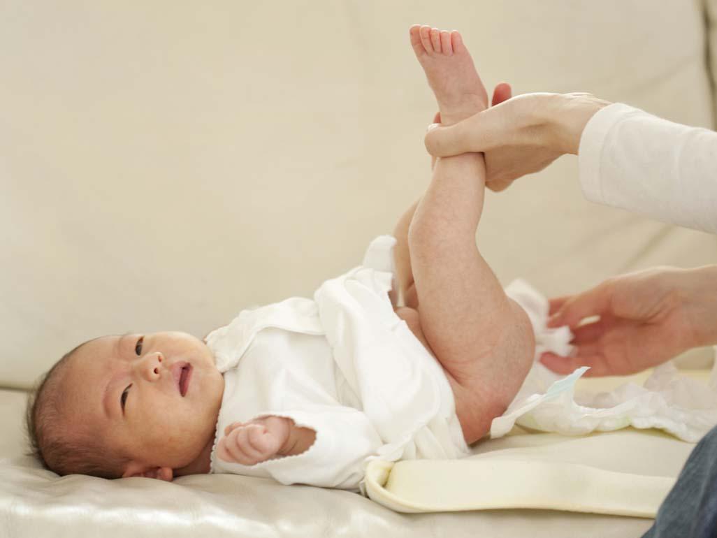 Nguyên nhân trẻ sơ sinh bị táo bón có thể do mắc các bệnh lý bẩm sinh